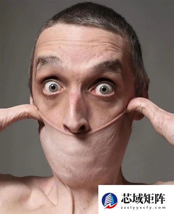 加里·特纳：皮肤可拉伸15.8厘米的活体橡皮人