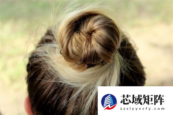 有救了:AI还能治疗脱发!定制化方案助你找回秀发