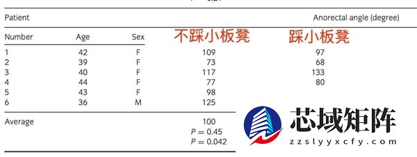 上厕所 坐着好还是蹲着好？最佳姿势竟然是……