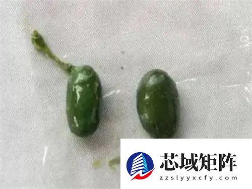 女子生吞鱼胆降火导致肝衰竭 医生：毒性堪比砒霜 无解药