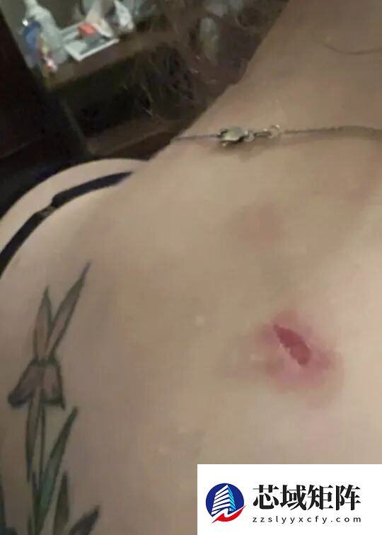 胖有胖的好！美国女子身中7枪奇迹存活：全凭一身脂肪挡子弹