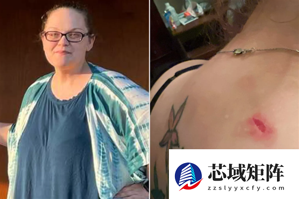 子弹卡在脂肪层 美国女子遇歹徒连中7枪奇迹生还！