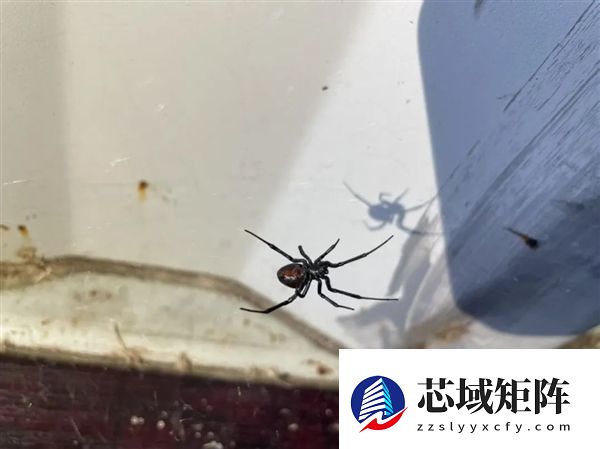 女子被蜘蛛咬后小腿肿成“大象腿” 医生：继发性淋巴水肿