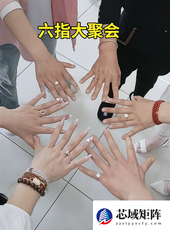 女子长12根手指自称灵活好用:吸粉超百万成大网红