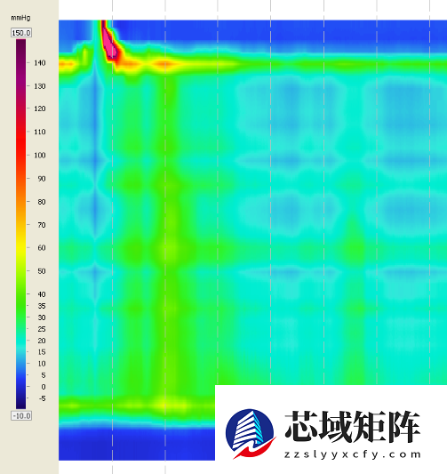 这4个信号是贲门在“求救” 很多人当成普遍胃病治 发现就晚了