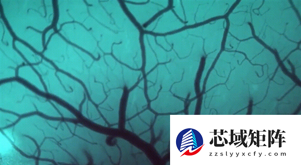 1.5秒植入！马斯克脑机接口公司技术新突破 超万人等待上脑