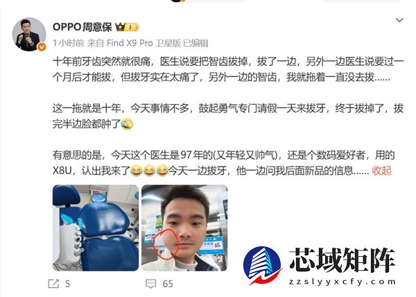 OPPO周意保去拔牙 牙医是O粉：一边拔牙一边问新机消息