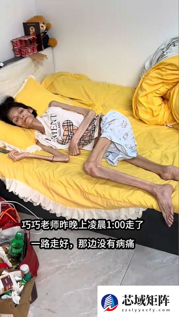 与病魔抗争2年 胃萎缩暴瘦至35斤女子去世：年仅27岁