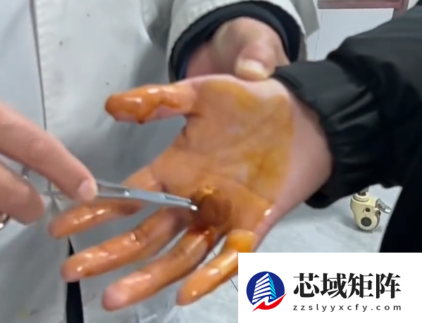 男子徒手摸灭火毯双手被刺钻心疼：主体材质玻璃纤维 需握黑色拉带