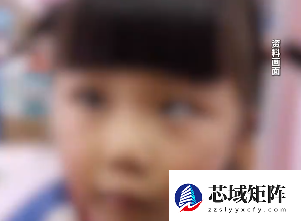 5岁女童沉迷玩手机变“斗鸡眼” 日均玩手机4至5小时
