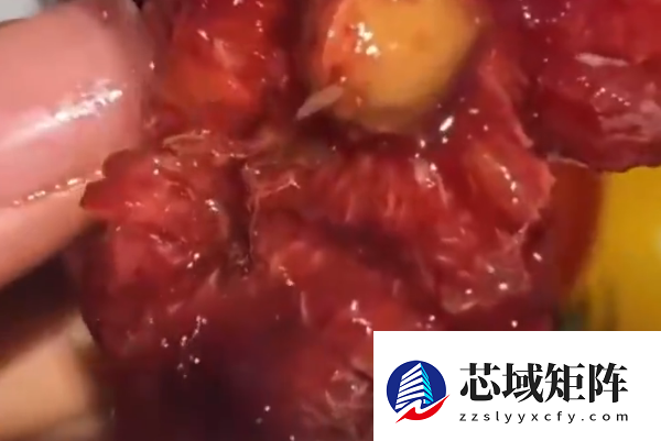 医生称车厘子果蝇的幼虫水洗不掉 需多流程进行清理