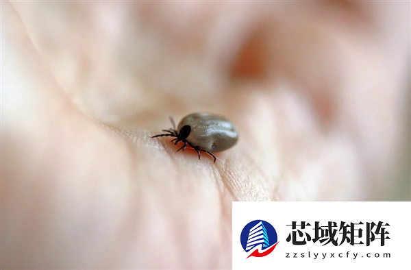 美飞行员户外被蜱虫叮咬 14天后吃烧烤+汉堡暴毙而亡