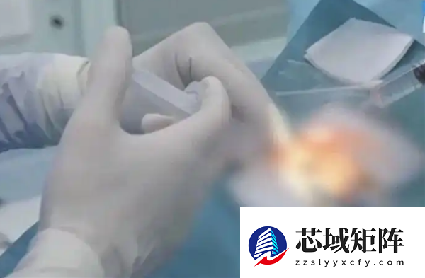 38岁女子宅家熬夜刷手机 眼压飙升诱发青光眼险失明