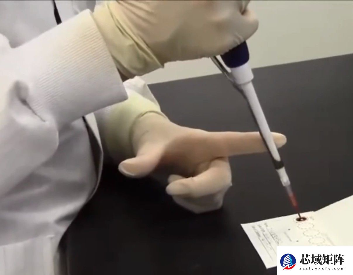 上海交大AI技术：一滴干血快速检测癌症