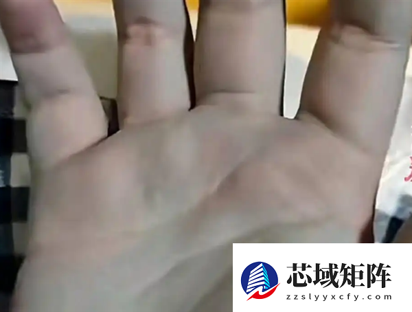 一家人吃自制牛瘪火锅中毒双手变蓝 加入一种不知名蔬菜