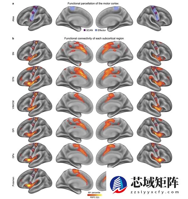 帕金森病治疗有新突破！我国科学家首次发现核心致病环路