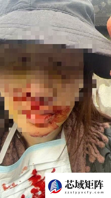 定了！国内知名女星金晨肇事逃逸被罚1500元 不构成犯罪