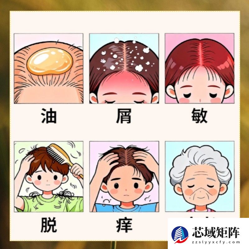 2025年度去屑洗发水实力榜