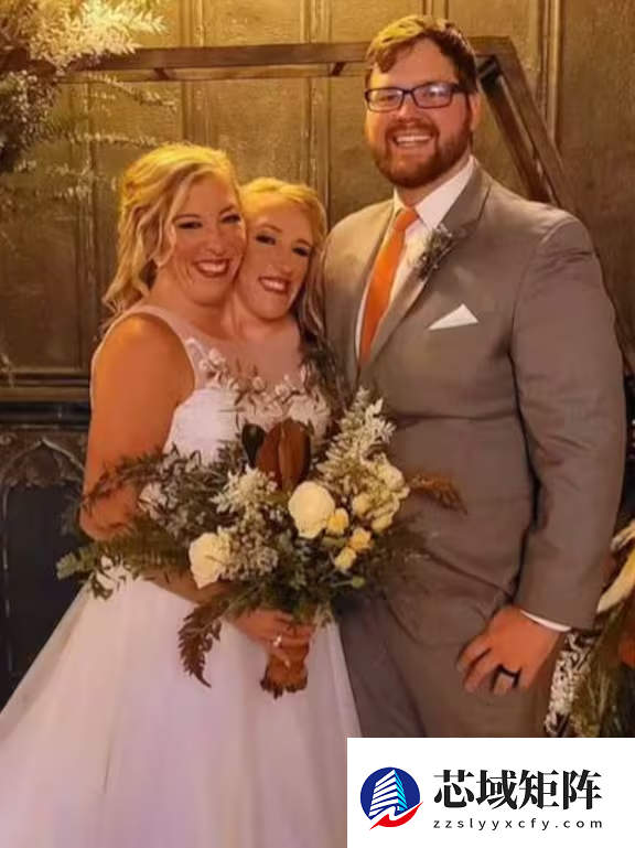 美国“连体姐妹花”火了 自爆私生活吸粉近30万：实非真人！