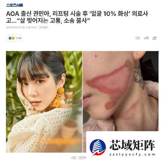 烧的太惨烈！韩国女星做医美竟然导致面度灼伤