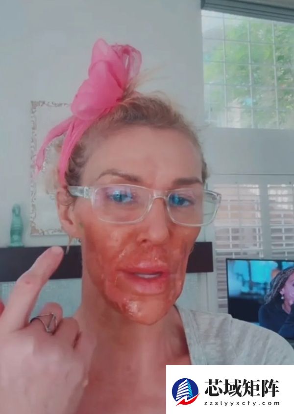 假体破裂导致面部受损