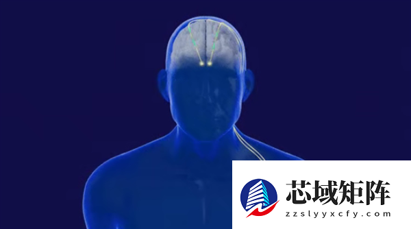 广西成功开展首例脑机接口手术：帕金森患者将实现生活自理！