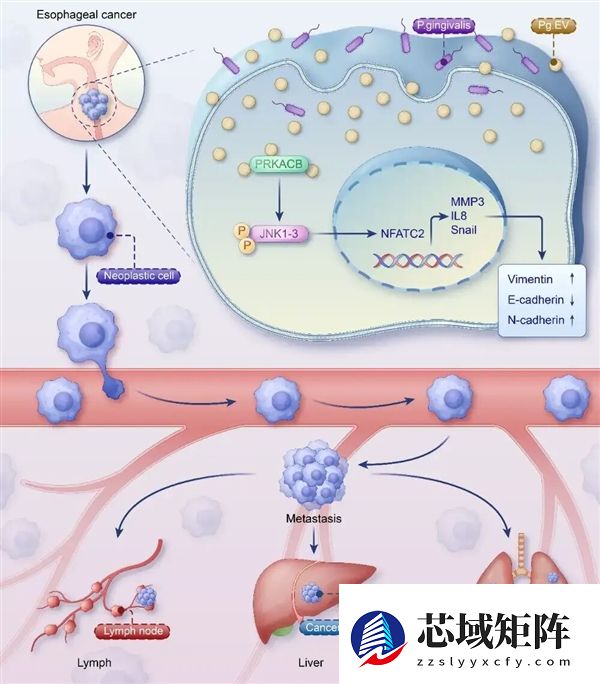 牙没刷好 竟然会助推癌细胞转移?