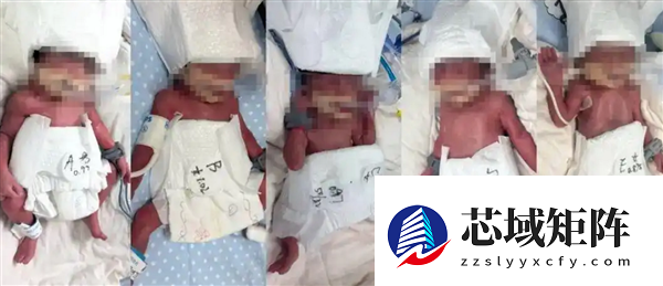 新疆24岁女子成功诞下1男4女5胞胎引全网祝福：堪称生命的极致奇迹