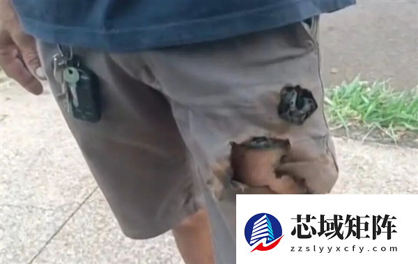巴西男子被两条狗狂咬 手机突然爆炸救了他一命