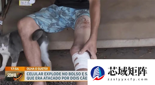 巴西男子被两条狗狂咬 手机突然爆炸救了他一命